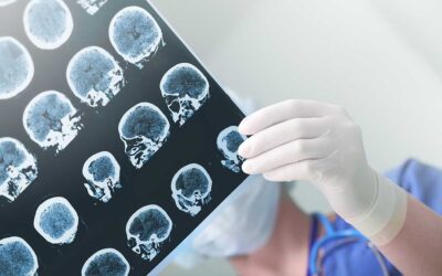 Traumatic Brain Injury is Serious